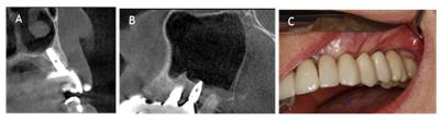 biomedres-openaccess-journal-bjstr