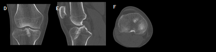 biomedres-openaccess-journal-bjstr