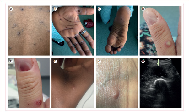 biomedres-openaccess-journal-bjstr