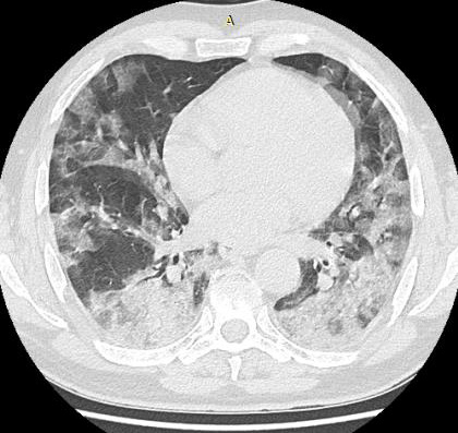 biomedres-openaccess-journal-bjstr