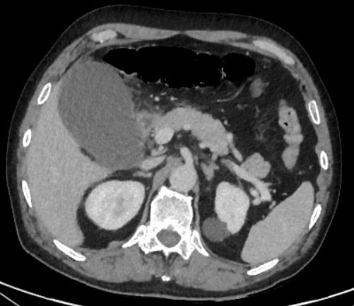 biomedres-openaccess-journal-bjstr