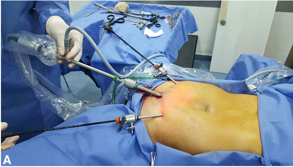 biomedres-openaccess-journal-bjstr