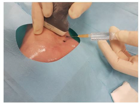 biomedres-openaccess-journal-bjstr
