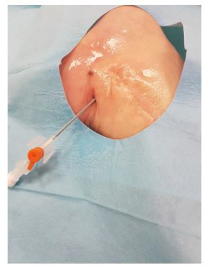 biomedres-openaccess-journal-bjstr
