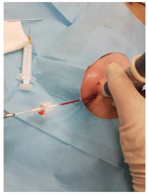 biomedres-openaccess-journal-bjstr