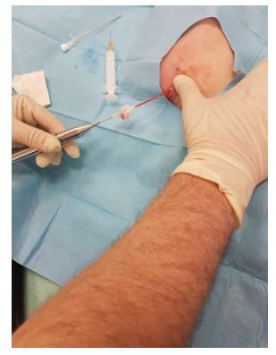 biomedres-openaccess-journal-bjstr