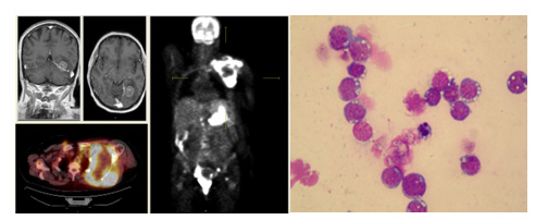 biomedres-openaccess-journal-bjstr