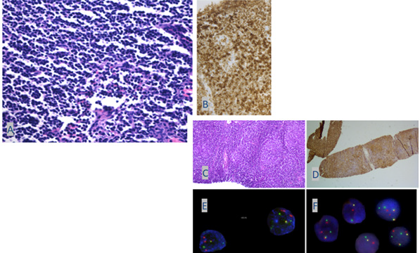 biomedres-openaccess-journal-bjstr