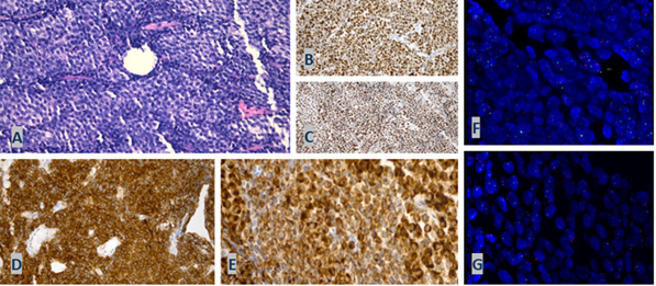 biomedres-openaccess-journal-bjstr