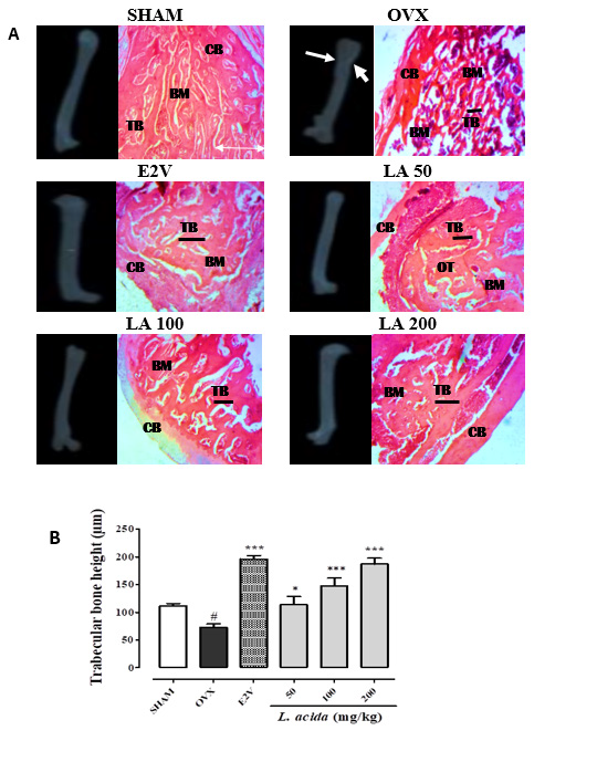 Click here to view Large Figure 2 biomedres-openaccess-journal-bjstr