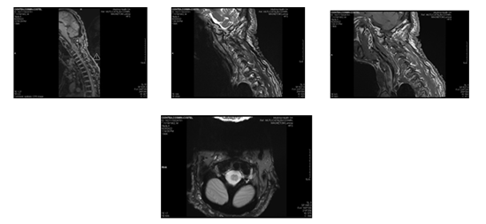 Click here to view Large Figure 2 biomedres-openaccess-journal-bjstr