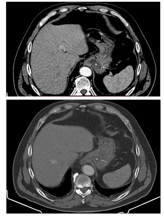 biomedres-openaccess-journal-bjstr