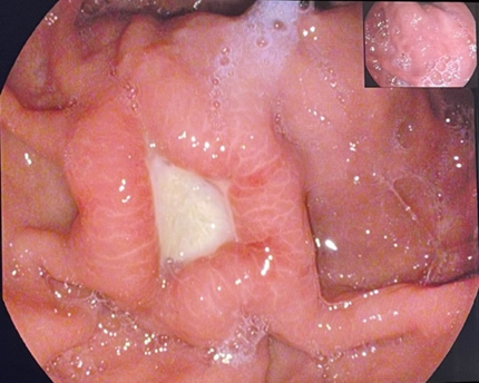biomedres-openaccess-journal-bjstr