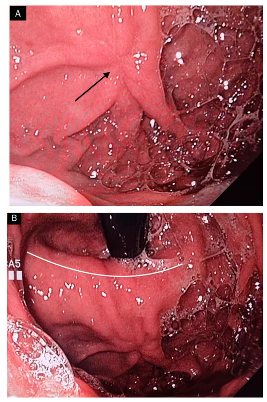 biomedres-openaccess-journal-bjstr