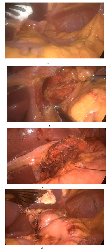 biomedres-openaccess-journal-bjstr