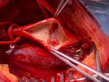 biomedres-openaccess-journal-bjstr