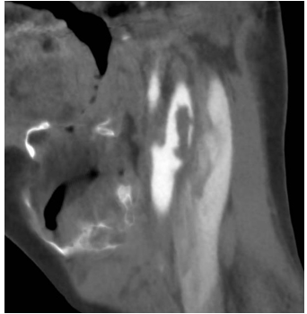 biomedres-openaccess-journal-bjstr