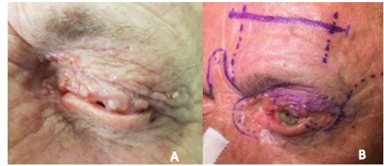 biomedres-openaccess-journal-bjstr