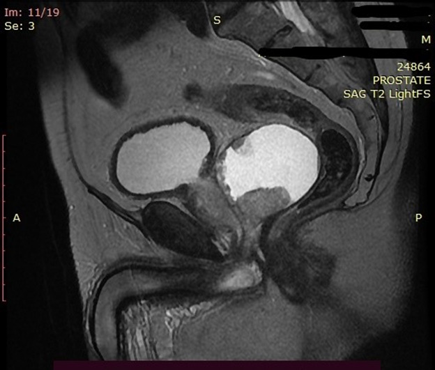 biomedres-openaccess-journal-bjstr