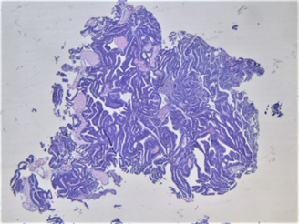biomedres-openaccess-journal-bjstr