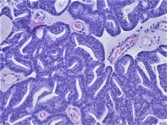 biomedres-openaccess-journal-bjstr