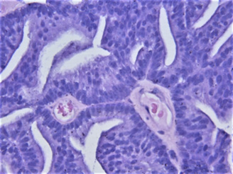biomedres-openaccess-journal-bjstr