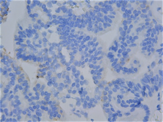 biomedres-openaccess-journal-bjstr
