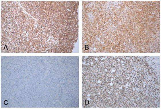 Click here to view Large Figure 2 biomedres-openaccess-journal-bjstr