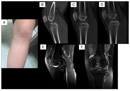biomedres-openaccess-journal-bjstr