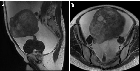 Click here to view Large Figure 1 biomedres-openaccess-journal-bjstr