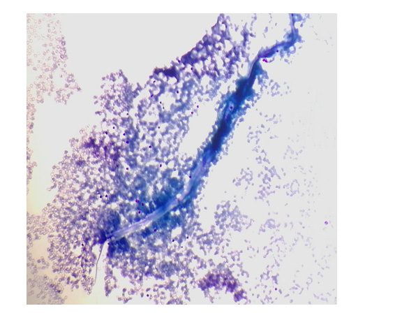 biomedres-openaccess-journal-bjstr