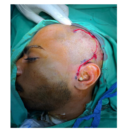 biomedres-openaccess-journal-bjstr