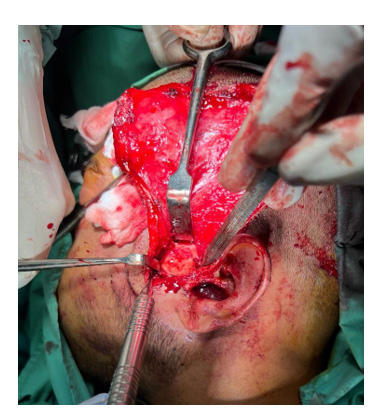 biomedres-openaccess-journal-bjstr