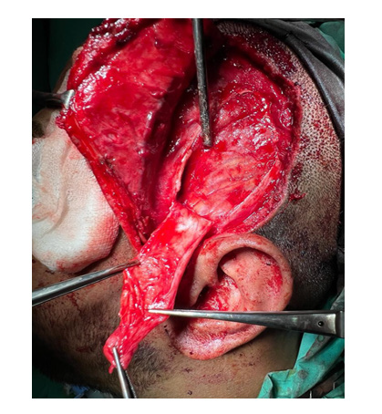 biomedres-openaccess-journal-bjstr