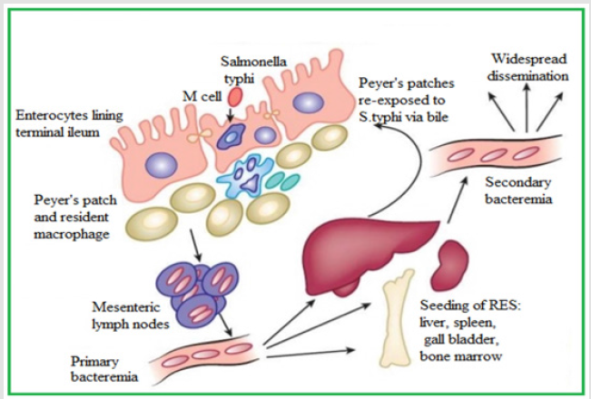 Click here to view Large Figure 1 biomedres-openaccess-journal-bjstr