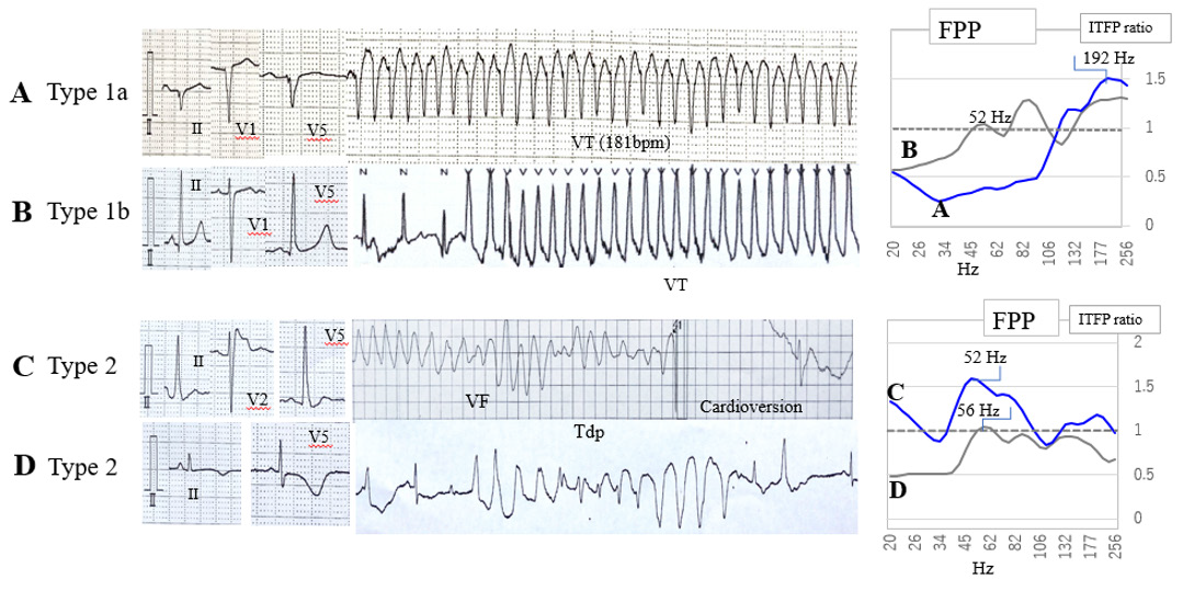 Click here to view Large Figure 4 biomedres-openaccess-journal-bjstr