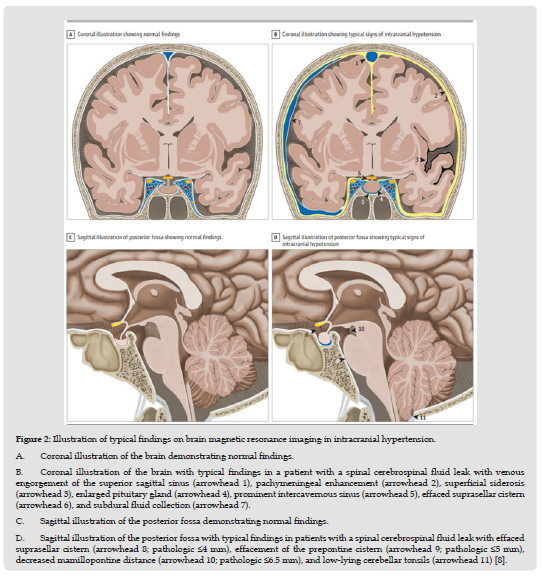 Click here to view Large Figure 2 biomedres-openaccess-journal-bjstr