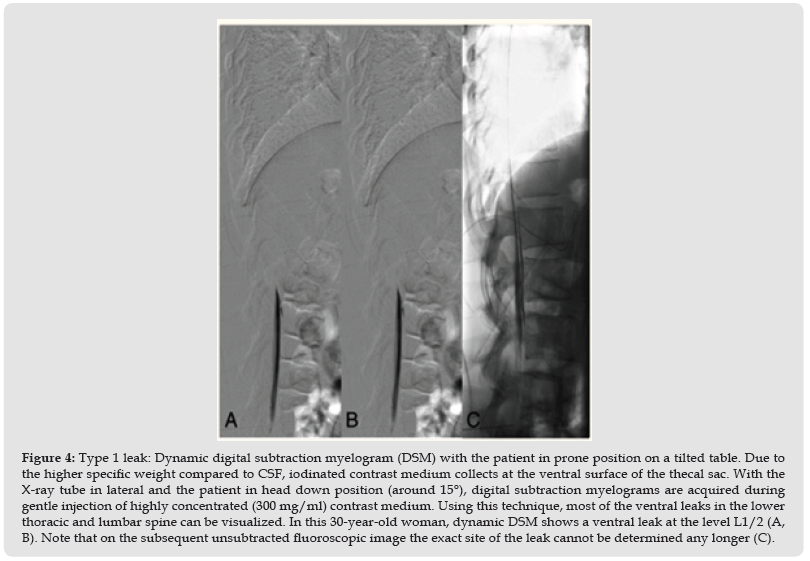 Click here to view Large Figure 4 biomedres-openaccess-journal-bjstr