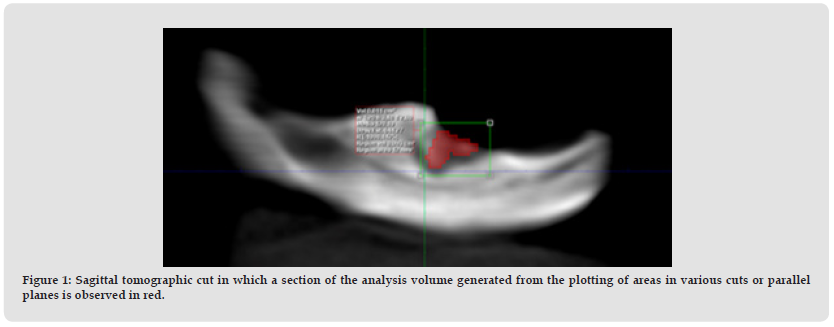 Click here to view Large Figure 1 biomedres-openaccess-journal-bjstr