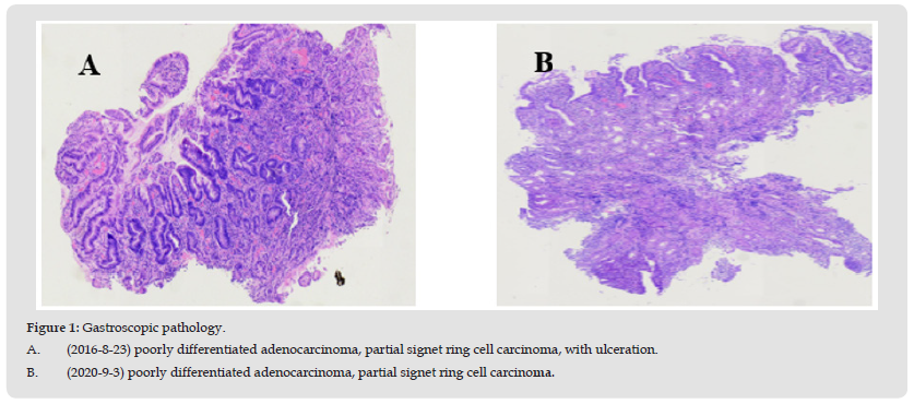 Click here to view Large Figure 1 biomedres-openaccess-journal-bjstr