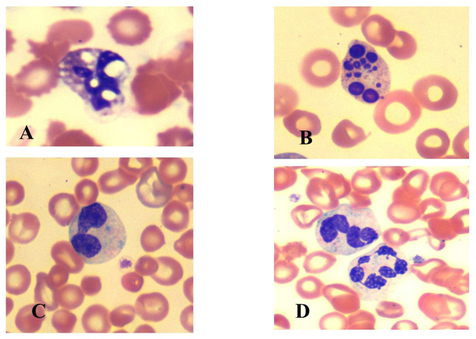 Click here to view Large Figure 2 biomedres-openaccess-journal-bjstr
