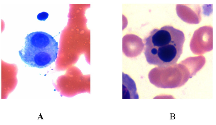 Click here to view Large Figure 3 biomedres-openaccess-journal-bjstr
