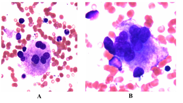 Click here to view Large Figure 4 biomedres-openaccess-journal-bjstr