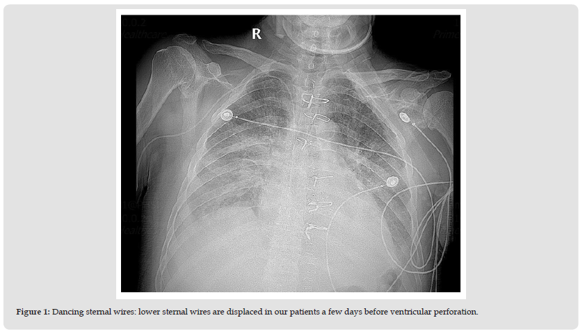 Click here to view Large Figure 1 biomedres-openaccess-journal-bjstr