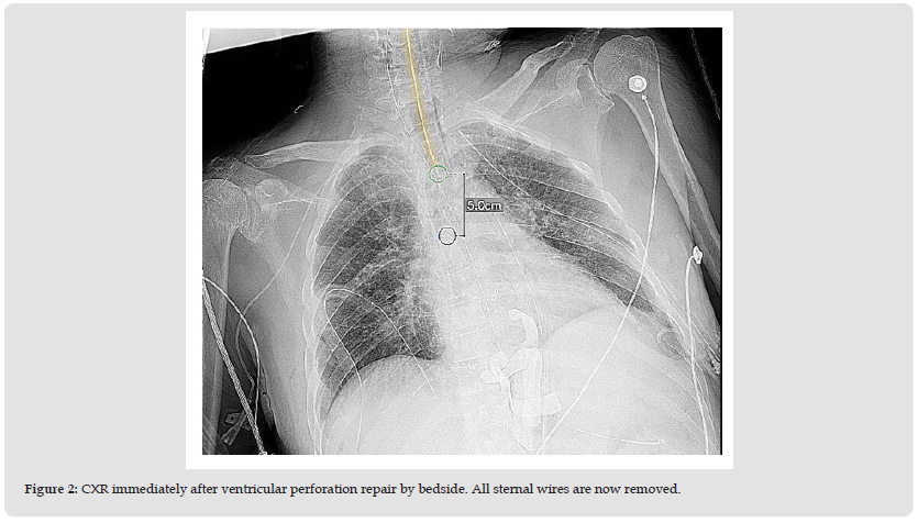 Click here to view Large Figure 2 biomedres-openaccess-journal-bjstr