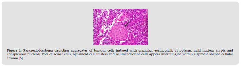 Click here to view Large Figure 1 biomedres-openaccess-journal-bjstr