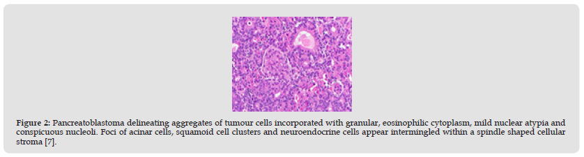 Click here to view Large Figure 2 biomedres-openaccess-journal-bjstr