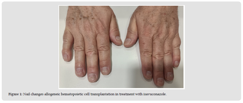 Click here to view Large Figure 1 biomedres-openaccess-journal-bjstr