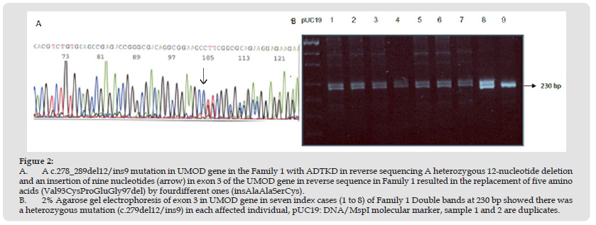 Click here to view Large Figure 2 biomedres-openaccess-journal-bjstr