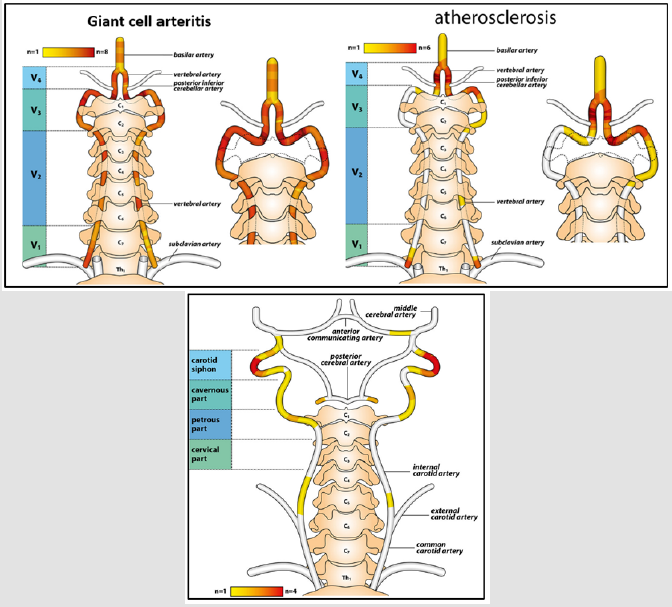 Click here to view Large Figure 1 biomedres-openaccess-journal-bjstr
